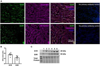 Loss of Function in Dopamine D3 Receptor Attenuates Left Ventricular Cardiac Fibroblast Migration and Proliferation in vitro